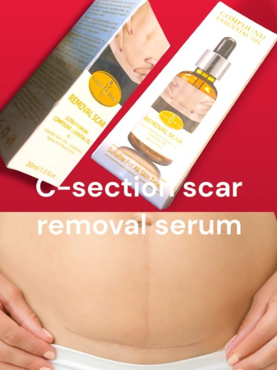 Acne Scar Removal